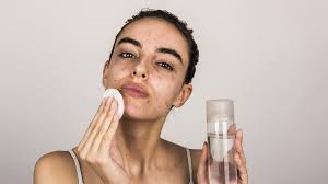💧 Skincare Tips for Oily Skin: Keep the Shine Under Control Naturally